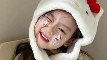 【Java 开发日记】RabbitMQ 里面的交换机是什么，你用过哪种？