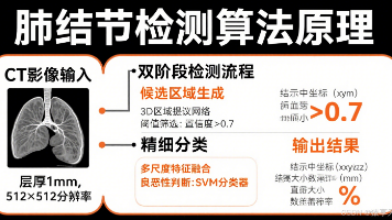 AI大模型实践项目：医学影像分类器（肺结节检测）